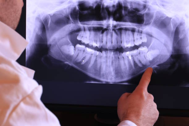 Best Emergency Dental Surgery in Cricket, NC