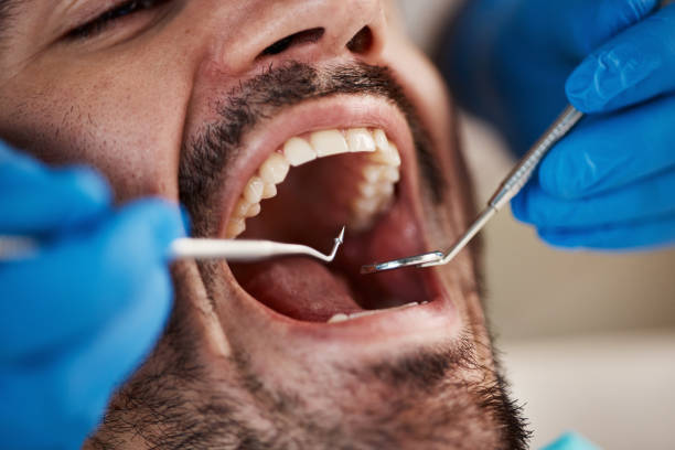 Best Same-Day Emergency Dentist in Cricket, NC